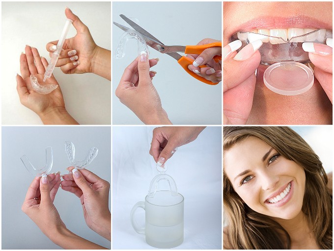 processo de branqueamento dentário beatifull white