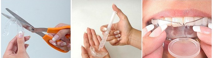 gel branqueamento dentário