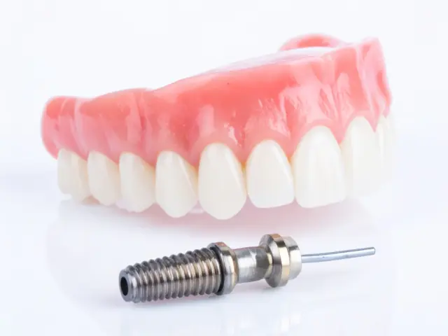 Componentes dos Implantes Dentários