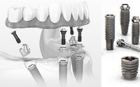 implantes dentários totais