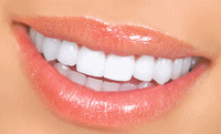 restauro dentário