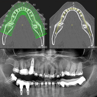 Radiografia Maxilares